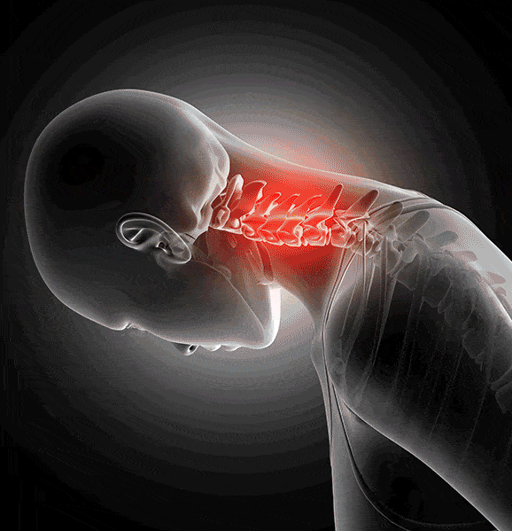 oreiller cervical, oreiller ergonomique cervical, oreiller mémoire de forme cervical, meilleur oreiller mal de cou
